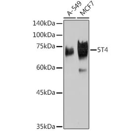 Western Blot - Anti-5T4 Antibody [ARC2167] (A306744) - Antibodies.com