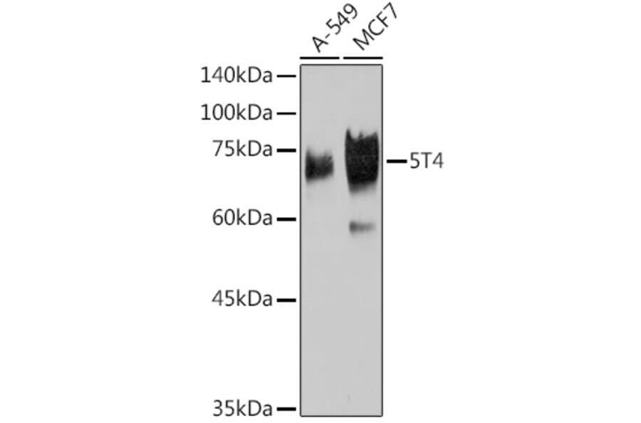 Western Blot - Anti-5T4 Antibody [ARC2167] (A306744) - Antibodies.com