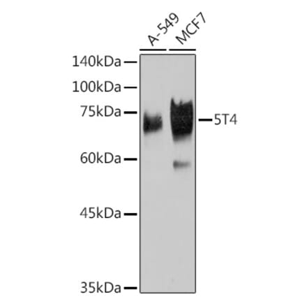 Western Blot - Anti-5T4 Antibody [ARC2167] (A306744) - Antibodies.com