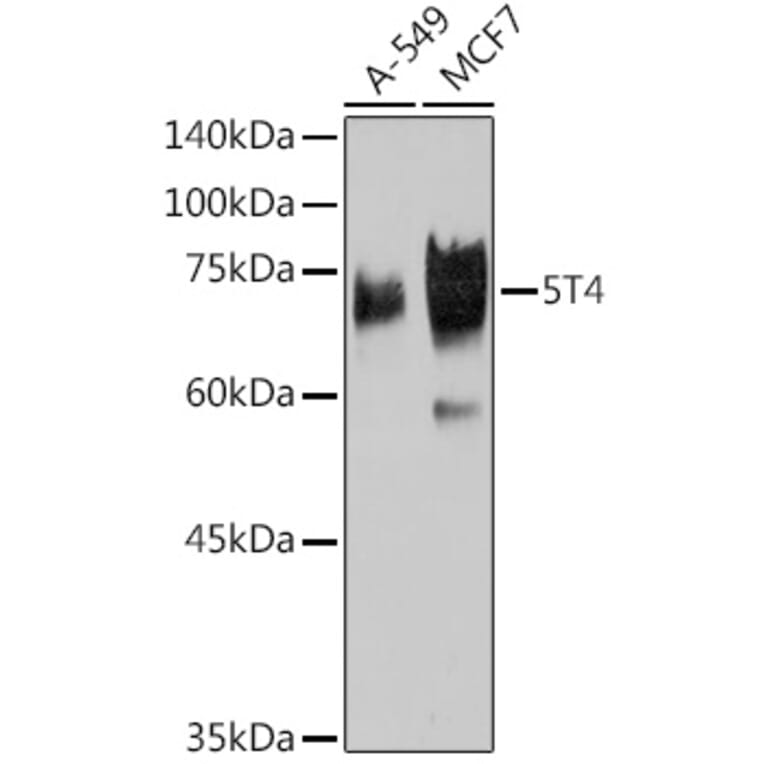 Western Blot - Anti-5T4 Antibody [ARC2167] (A306744) - Antibodies.com