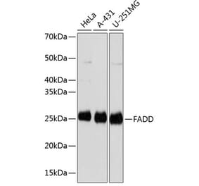 Western Blot - Anti-FADD Antibody [ARC0415] (A306745) - Antibodies.com