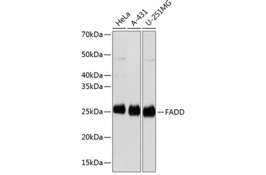 Western Blot - Anti-FADD Antibody [ARC0415] (A306745) - Antibodies.com