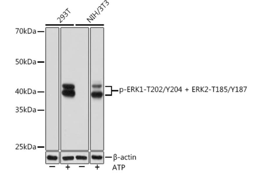 Western Blot - Anti-ERK1 (phospho Thr202 + Tyr204) + ERK2 (phospho Thr185 + Tyr187) Antibody [ARC1595] (A306747) - Antibodies.com