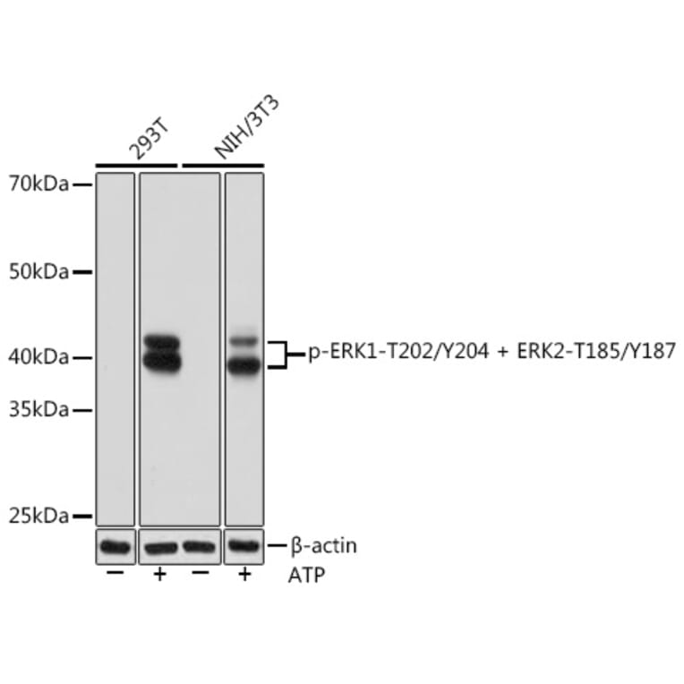 Western Blot - Anti-ERK1 (phospho Thr202 + Tyr204) + ERK2 (phospho Thr185 + Tyr187) Antibody [ARC1595] (A306747) - Antibodies.com