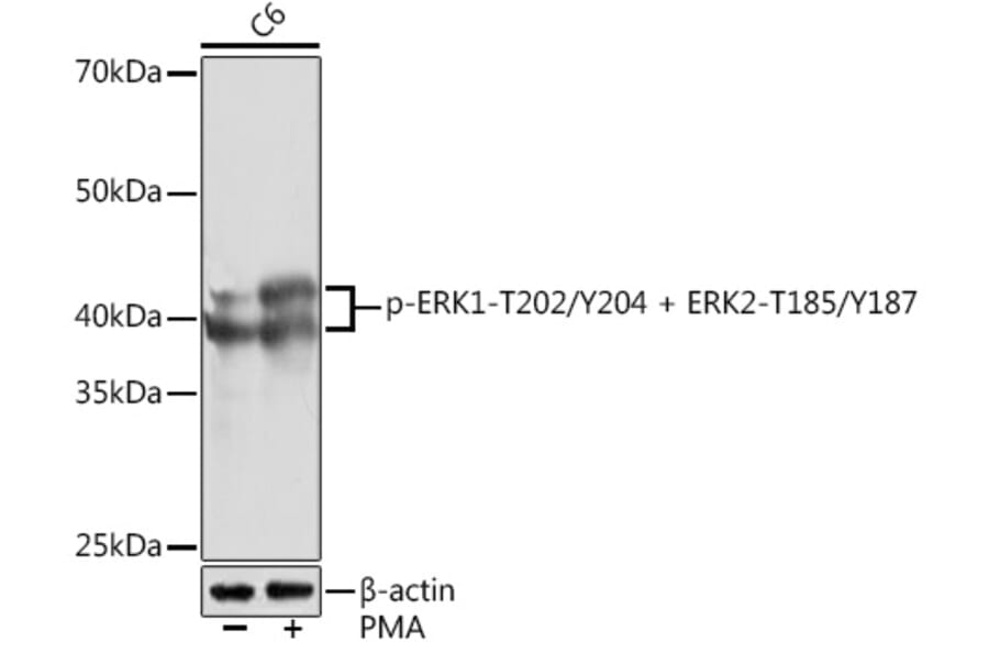 Western Blot - Anti-ERK1 (phospho Thr202 + Tyr204) + ERK2 (phospho Thr185 + Tyr187) Antibody [ARC1595] (A306747) - Antibodies.com