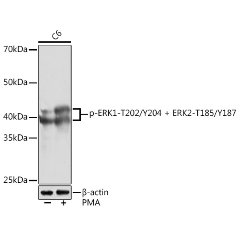 Western Blot - Anti-ERK1 (phospho Thr202 + Tyr204) + ERK2 (phospho Thr185 + Tyr187) Antibody [ARC1595] (A306747) - Antibodies.com