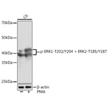 Western Blot - Anti-ERK1 (phospho Thr202 + Tyr204) + ERK2 (phospho Thr185 + Tyr187) Antibody [ARC1595] (A306747) - Antibodies.com