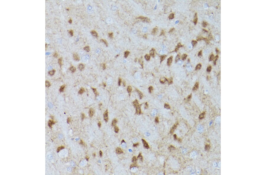 Immunohistochemistry - Anti-ERK1 (phospho Thr202 + Tyr204) + ERK2 (phospho Thr185 + Tyr187) Antibody [ARC1595] (A306747) - Antibodies.com