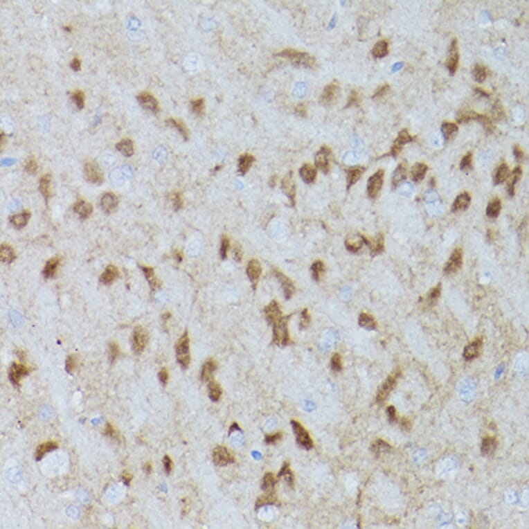 Immunohistochemistry - Anti-ERK1 (phospho Thr202 + Tyr204) + ERK2 (phospho Thr185 + Tyr187) Antibody [ARC1595] (A306747) - Antibodies.com