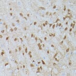 Immunohistochemistry - Anti-ERK1 (phospho Thr202 + Tyr204) + ERK2 (phospho Thr185 + Tyr187) Antibody [ARC1595] (A306747) - Antibodies.com