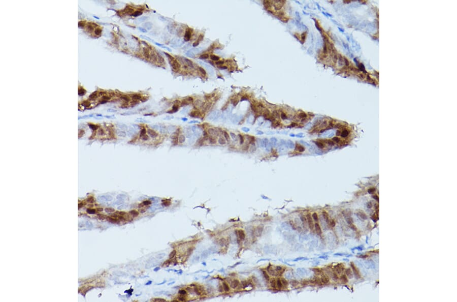 Immunohistochemistry - Anti-ERK1 (phospho Thr202 + Tyr204) + ERK2 (phospho Thr185 + Tyr187) Antibody [ARC1595] (A306747) - Antibodies.com