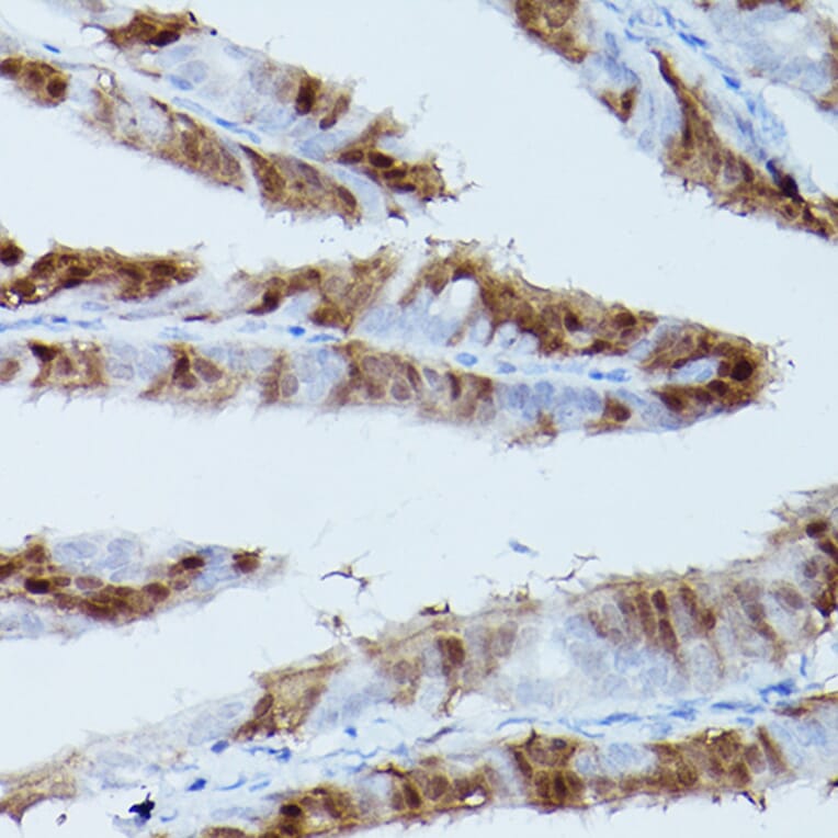 Immunohistochemistry - Anti-ERK1 (phospho Thr202 + Tyr204) + ERK2 (phospho Thr185 + Tyr187) Antibody [ARC1595] (A306747) - Antibodies.com
