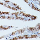 Immunohistochemistry - Anti-ERK1 (phospho Thr202 + Tyr204) + ERK2 (phospho Thr185 + Tyr187) Antibody [ARC1595] (A306747) - Antibodies.com