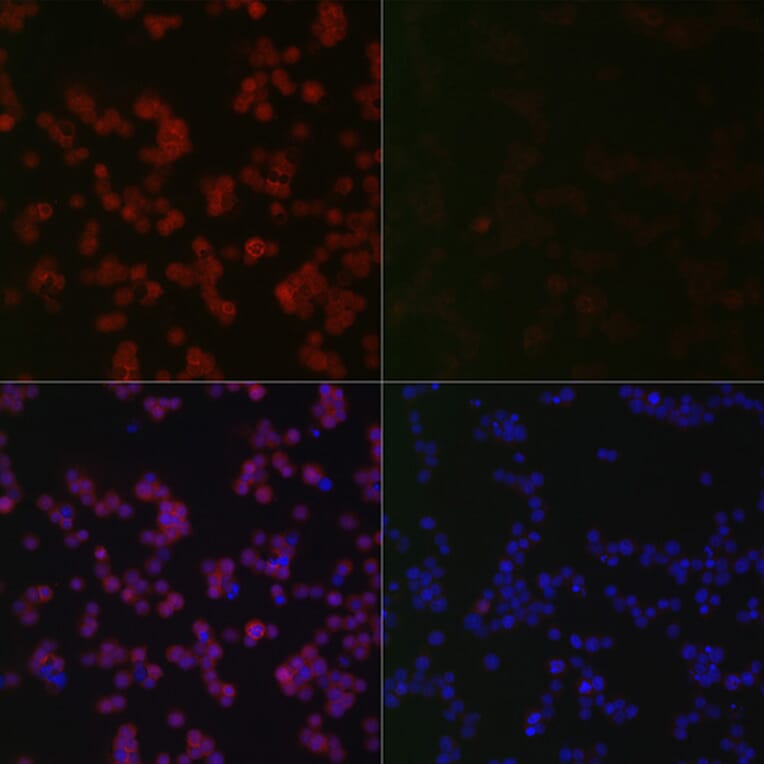 Immunofluorescence - Anti-ERK1 (phospho Thr202 + Tyr204) + ERK2 (phospho Thr185 + Tyr187) Antibody [ARC1595] (A306747) - Antibodies.com