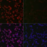 Immunofluorescence - Anti-ERK1 (phospho Thr202 + Tyr204) + ERK2 (phospho Thr185 + Tyr187) Antibody [ARC1595] (A306747) - Antibodies.com