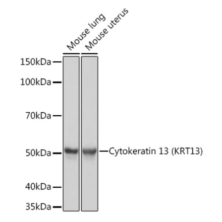 Western Blot - Anti-Cytokeratin 13 Antibody [ARC1824] (A306748) - Antibodies.com