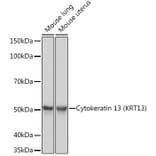 Western Blot - Anti-Cytokeratin 13 Antibody [ARC1824] (A306748) - Antibodies.com