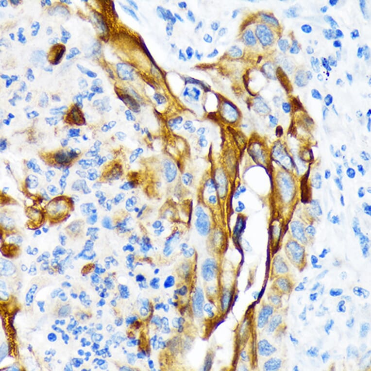 Immunohistochemistry - Anti-Cytokeratin 13 Antibody [ARC1824] (A306748) - Antibodies.com