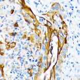 Immunohistochemistry - Anti-Cytokeratin 13 Antibody [ARC1824] (A306748) - Antibodies.com