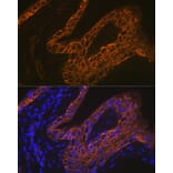 Immunofluorescence - Anti-Cytokeratin 13 Antibody [ARC1824] (A306748) - Antibodies.com