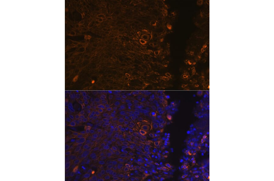 Immunofluorescence - Anti-Cytokeratin 13 Antibody [ARC1824] (A306748) - Antibodies.com