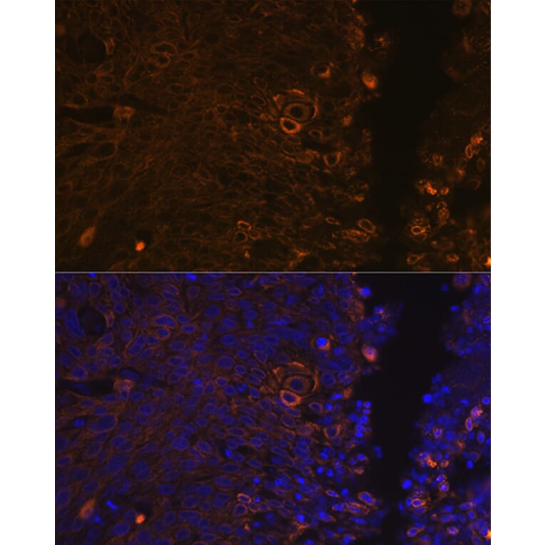 Immunofluorescence - Anti-Cytokeratin 13 Antibody [ARC1824] (A306748) - Antibodies.com