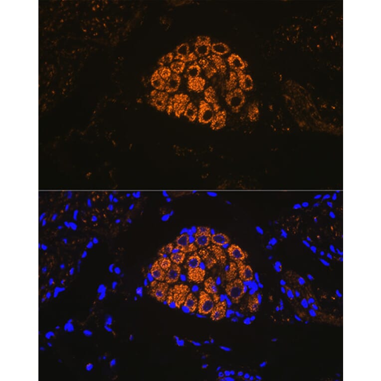 Immunofluorescence - Anti-Cytokeratin 13 Antibody [ARC1824] (A306748) - Antibodies.com