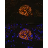 Immunofluorescence - Anti-Cytokeratin 13 Antibody [ARC1824] (A306748) - Antibodies.com