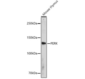 Western Blot - Anti-PERK Antibody (A306749) - Antibodies.com