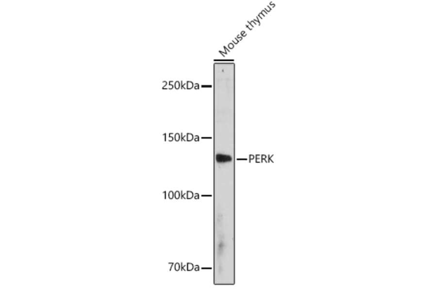 Western Blot - Anti-PERK Antibody (A306749) - Antibodies.com