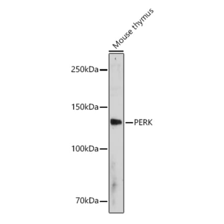 Western Blot - Anti-PERK Antibody (A306749) - Antibodies.com