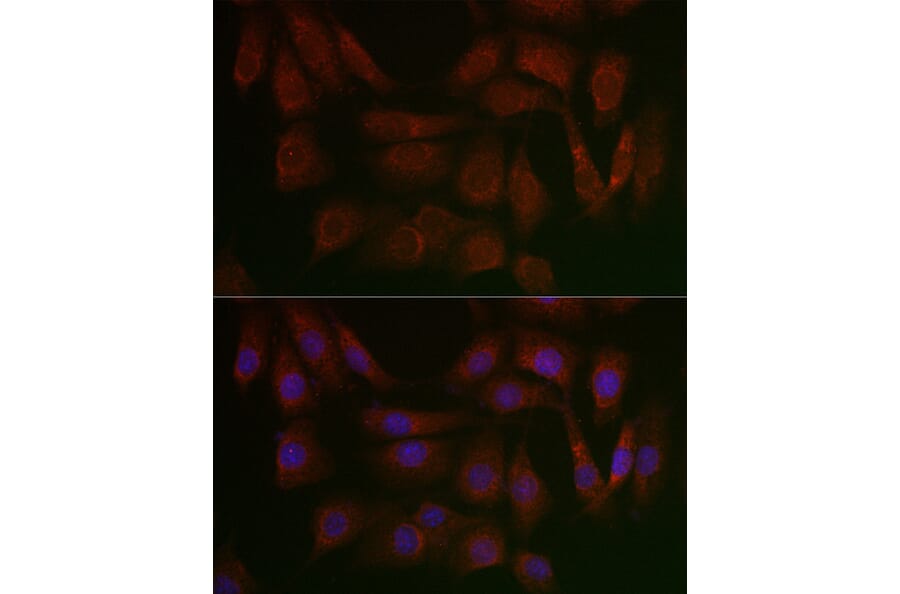 Immunofluorescence - Anti-PERK Antibody (A306749) - Antibodies.com