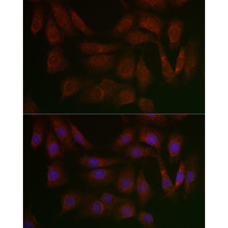 Immunofluorescence - Anti-PERK Antibody (A306749) - Antibodies.com