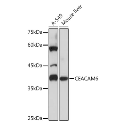 Western Blot - Anti-CEACAM6 Antibody [ARC2110] (A306750) - Antibodies.com