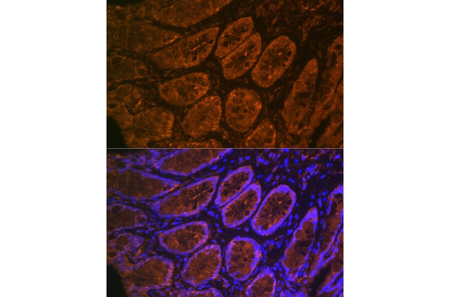 Immunofluorescence - Anti-CEACAM6 Antibody [ARC2110] (A306750) - Antibodies.com