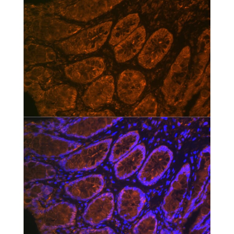 Immunofluorescence - Anti-CEACAM6 Antibody [ARC2110] (A306750) - Antibodies.com