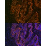 Immunofluorescence - Anti-CEACAM6 Antibody [ARC2110] (A306750) - Antibodies.com