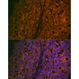 Immunofluorescence - Anti-CEACAM6 Antibody [ARC2110] (A306750) - Antibodies.com