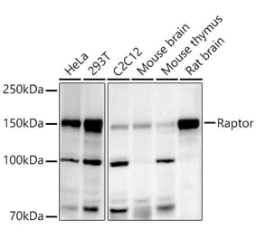 Western Blot - Anti-Raptor Antibody (A306753) - Antibodies.com