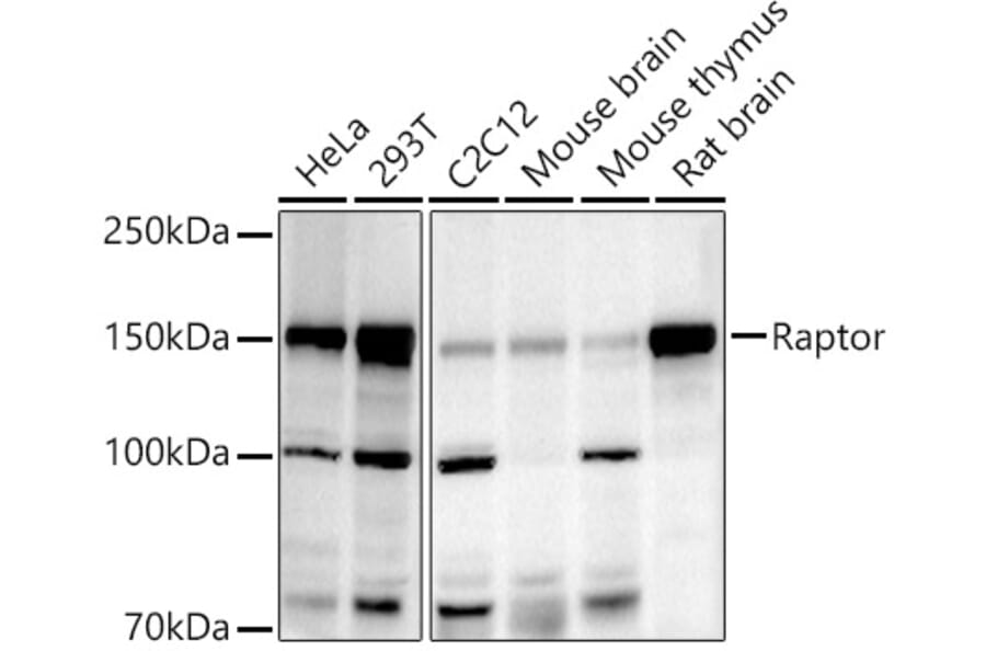 Western Blot - Anti-Raptor Antibody (A306753) - Antibodies.com