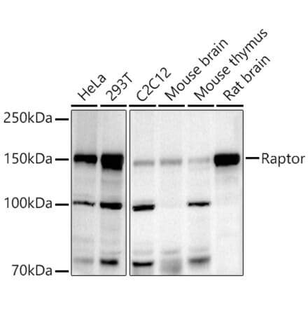 Western Blot - Anti-Raptor Antibody (A306753) - Antibodies.com