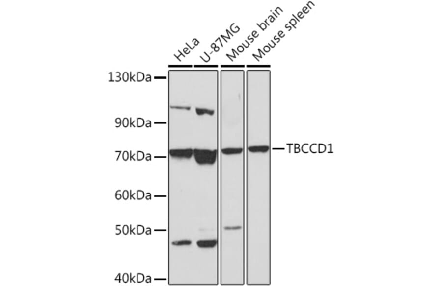 Western Blot - Anti-TBCCD1 Antibody (A306754) - Antibodies.com
