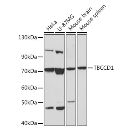 Western Blot - Anti-TBCCD1 Antibody (A306754) - Antibodies.com