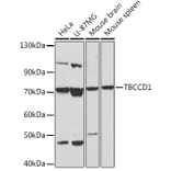 Western Blot - Anti-TBCCD1 Antibody (A306754) - Antibodies.com