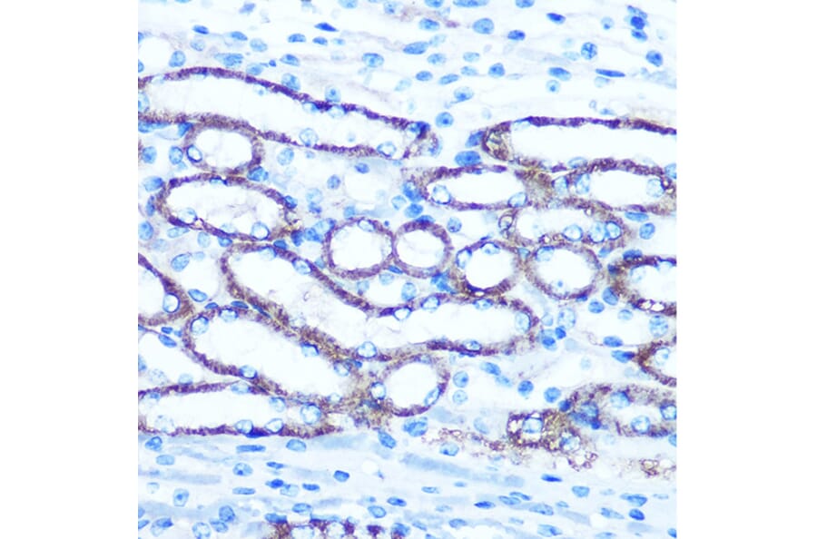 Immunohistochemistry - Anti-TBCCD1 Antibody (A306754) - Antibodies.com