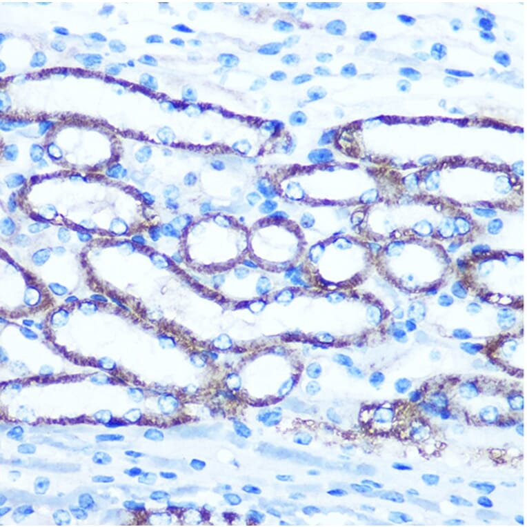 Immunohistochemistry - Anti-TBCCD1 Antibody (A306754) - Antibodies.com