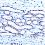 Immunohistochemistry - Anti-TBCCD1 Antibody (A306754) - Antibodies.com