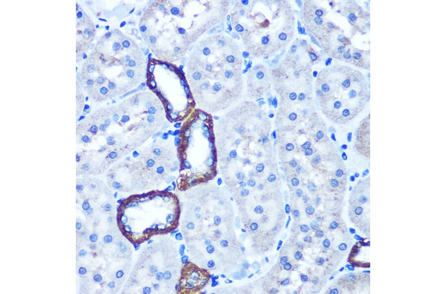 Immunohistochemistry - Anti-TBCCD1 Antibody (A306754) - Antibodies.com