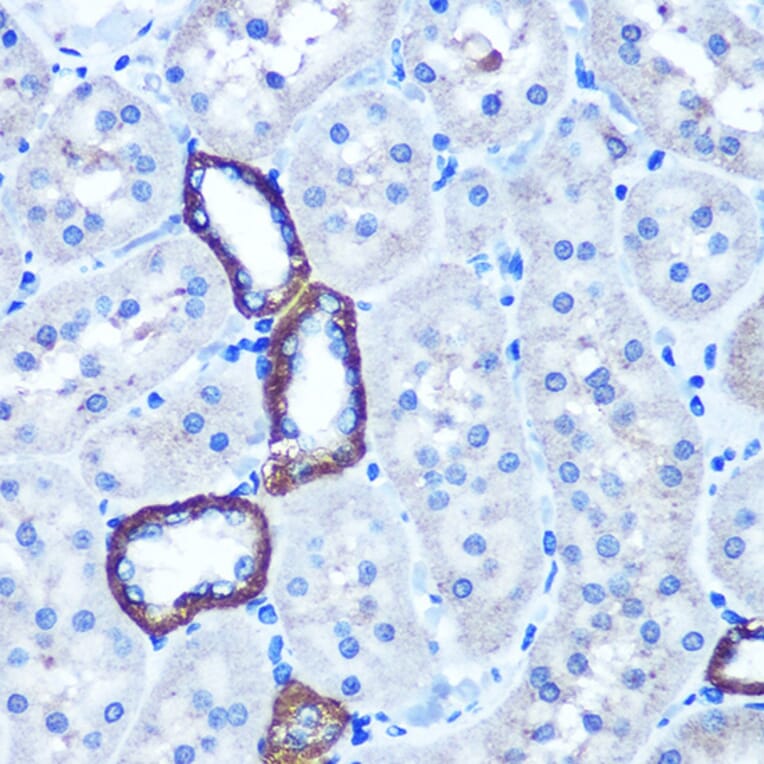 Immunohistochemistry - Anti-TBCCD1 Antibody (A306754) - Antibodies.com