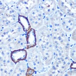 Immunohistochemistry - Anti-TBCCD1 Antibody (A306754) - Antibodies.com